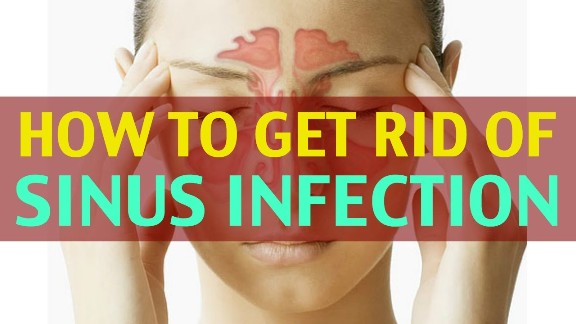 How to Get Rid of Sinus Infection?