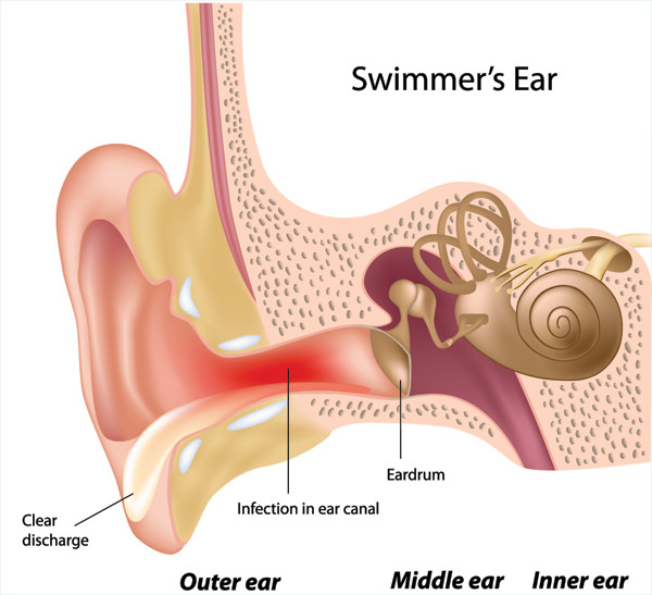 How To Remove Water In The Ears After Swimming