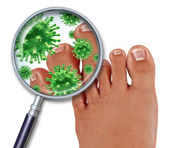 Hydrogen Peroxide Uses for Foot Fungus