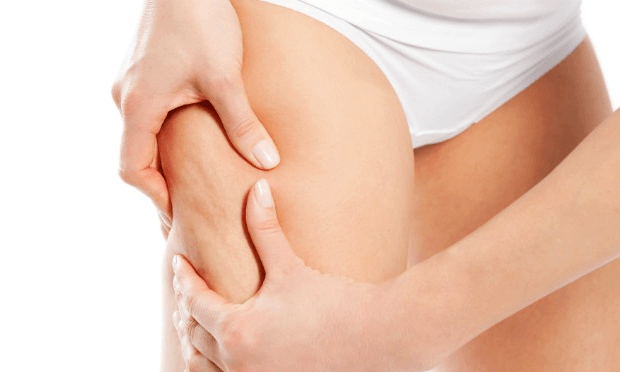 Home Remedies for Cellulite Reduction