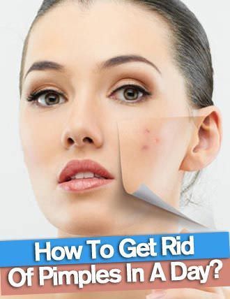how to get rid of pimples overnight fast naturally