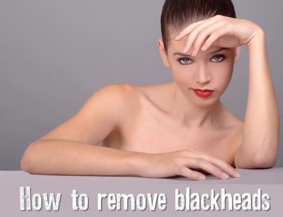 blackhead removal how to remove blackheads