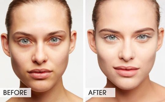 Remove Dark Circles Under Your Eyes Naturally and Fast