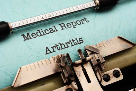 Home Remedies for Arthritis Treatment Naturally at Home