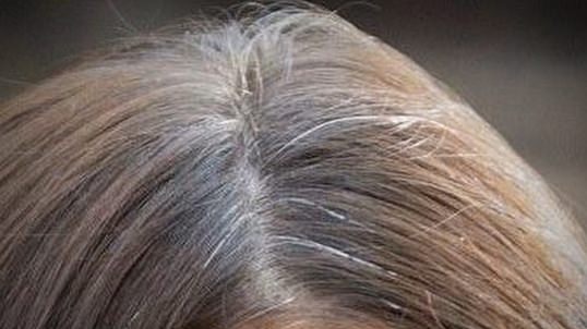 Home Remedies to Stop Gray Hair
