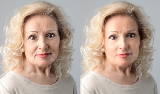 Home Remedies for Wrinkles Get Rid of Wrinkles Naturally