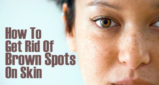 How to Get Rid of Brown Spots with Home Remedies