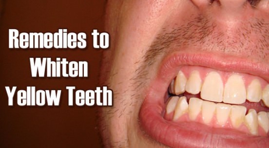 Natural Ways to Whiten Teeth at Home