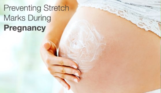 How to avoid stretch marks in pregnancy stretch marks