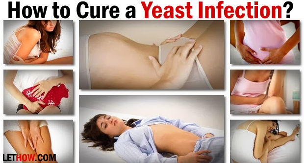 How to Cure a Yeast Infection