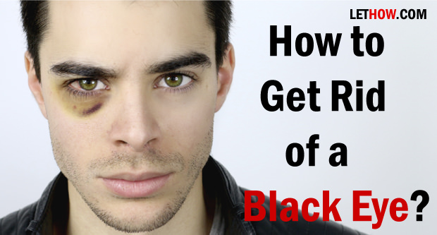 How to Get Rid of a Black Eye