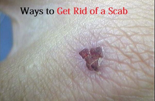 get rid of a scab