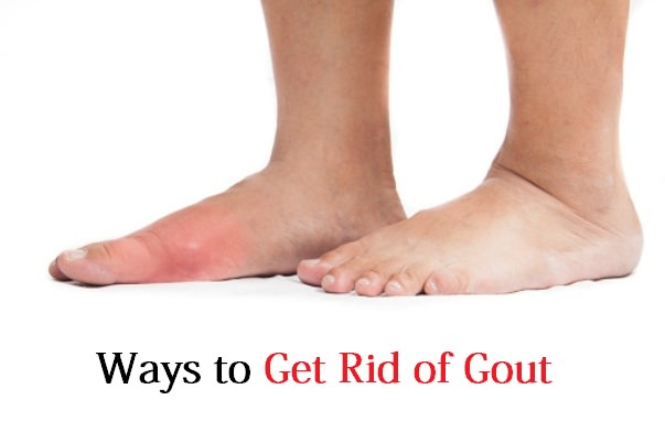 get rid of gout