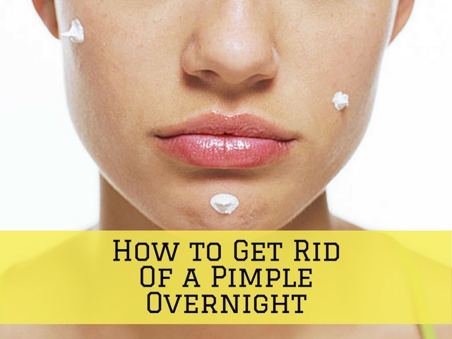 how to get rid of a pimple overnight