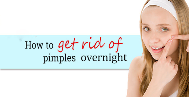 how to get rid of pimples overnight fast naturally