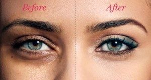 Get rid of dark circles under your eyes fast & permanently