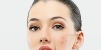 Get Rid Of Acne Overnight Fast