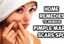 how to remove pimple marks get rid of pimple marks