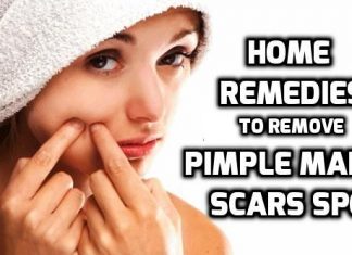 how to remove pimple marks get rid of pimple marks