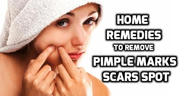 How To Remove Pimple Marks And Acne Marks From Face 