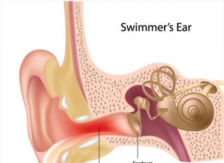 Remove Water From Ear Home Remedy