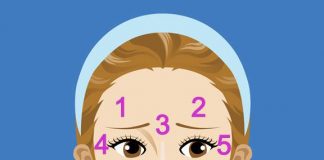 Acne Face Map Face Mapping Acne What Your Acne Telling You