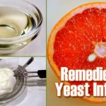 Home Remedies for Yeast Infection Treatment Naturally