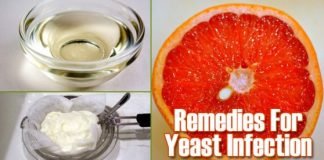 Home Remedies for Yeast Infection Treatment Naturally