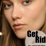 how to get rid of blackheads with glue