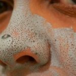 How to get rid of blackheads on nose fast and natural home remedies