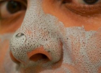 How to get rid of blackheads on nose fast and natural home remedies