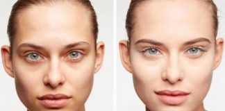 Get Rid of Dark Circles Under Your Eyes Naturally and Fast