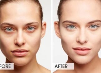 Get Rid of Dark Circles Under Your Eyes Naturally and Fast