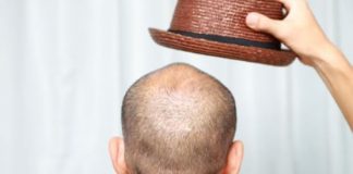 How to Prevent Hair Loss in Women and Men