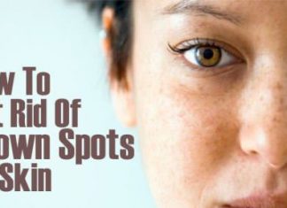 How to Get Rid of Brown Spots with Home Remedies