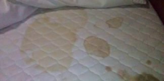 How to Remove Blood Stains Mattress Carpet Sheets Clothes