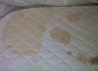 How to Remove Blood Stains Mattress Carpet Sheets Clothes
