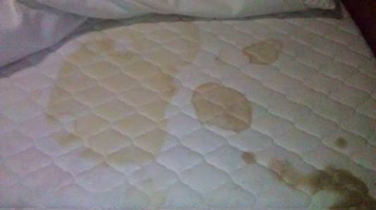 How to Remove Blood Stains? (Mattress, Sheets, Carpet and