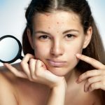 how to cure pimples treat pimples once for all