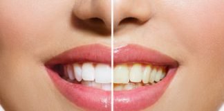 How to Use Hydrogen Peroxide to Whiten Teeth