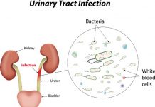 Home Remedies for UTI Urinary Tract Infection Herbal Teas
