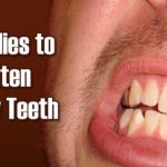Natural Ways to Whiten Teeth at Home