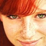 How to Get Rid of Freckles Home Remedies