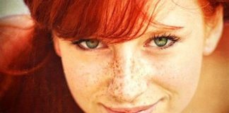 How to Get Rid of Freckles Home Remedies