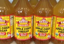 Apple cider Vinegar For Stretch Marks Removal Naturally