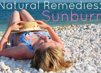 How to Get Rid of Sunburn - Natural Sunburn Remedies