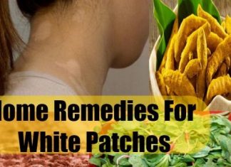 Home Remedies For White Spots on Skin
