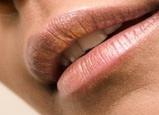 Home Remedies for Black Lips