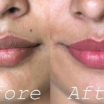 Home Remedies to Get Rid of Dark Lips Naturally