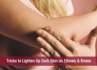 How Get Rid Of Black Knees And Elbows